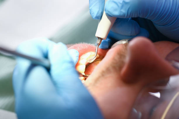 Emergency Dentist for Kids in NJ
