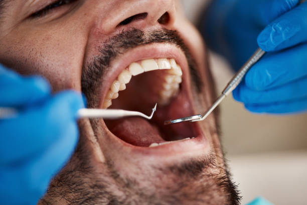 Best Emergency Dental Filling Replacement  in Lambertville, NJ